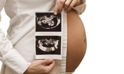 Il parto podalico Il parto podalico