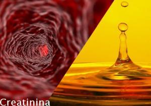 Creatinina Creatinina