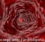 Anticorpi anti cardiolipina