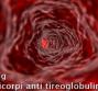 AbTg - Anticorpi anti tireoglobulina
