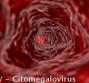 CMV - Citomegalovirus