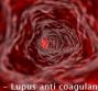 LAC – Lupus anti coagulante