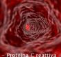 PCR – Proteina C reattiva