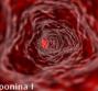 Troponina I