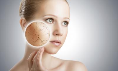 Creme emollienti: come sceglierle