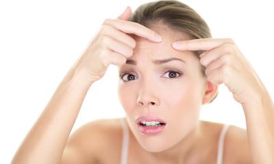 Maschere fai da te per combattere l’acne