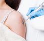 Come cancellare i tatuaggi
