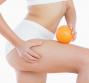 Vitamina C contro la cellulite