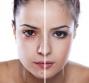 Blur: la crema effetto Photoshop