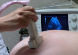 Flussimetria doppler