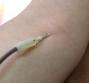 Esami ematochimici