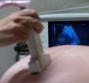 Flussimetria doppler