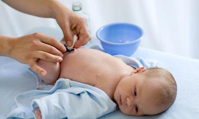 Come disinfettare l'ombelico del neonato