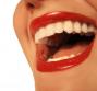 Denti