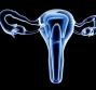 Utero