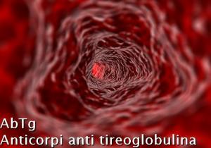 AbTg - Anticorpi anti tireoglobulina