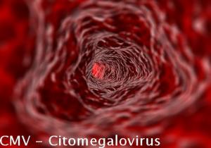 CMV - Citomegalovirus