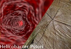 Helicobacter Pylori