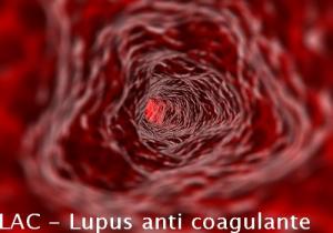 LAC – Lupus anti coagulante