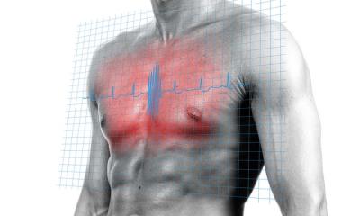 Cardiomiopatia