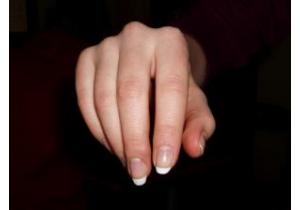 Malattie delle unghie delle mani