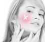 Acne rosacea 