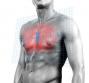 Cardiomiopatia