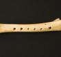 Osteopenia